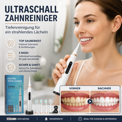 💎Überraschungspreis 19,99 €!!🦷✨Elektrischer Ultraschall-Zahnsteinentferner zur Entfernung von Zahnstein und Zahnbelag